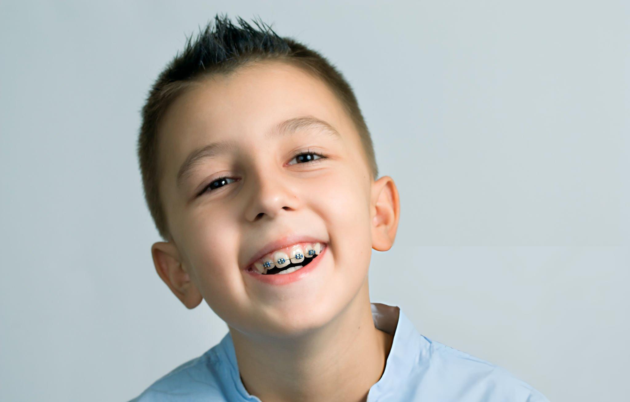 Braces for Children & Adult Braces Basingstoke