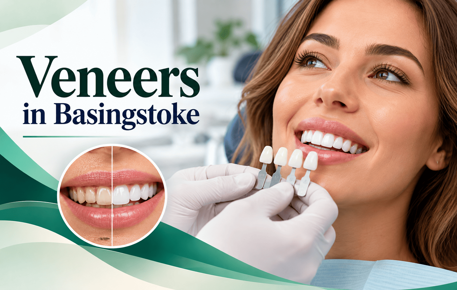 Veneers Basingstoke | Cosmetic Dentistry | Hampshire Dental Care