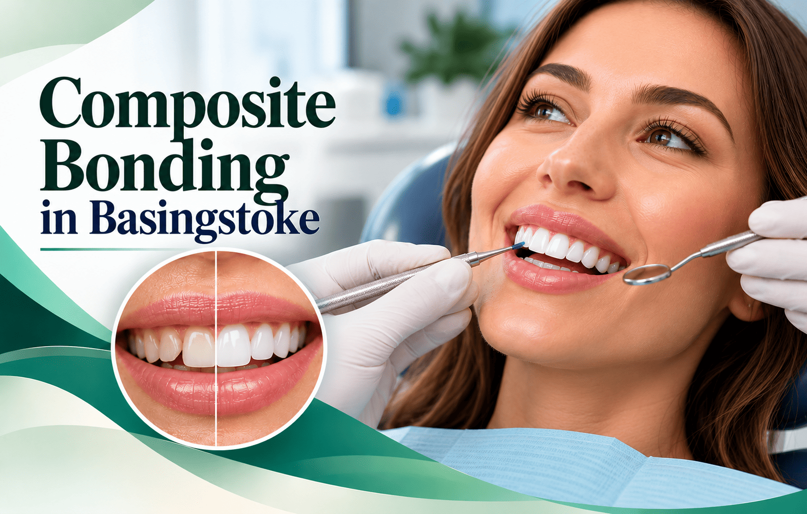 Composite Bonding Cost Basingstoke